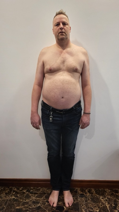 Marcel trước keto, tháng 10 năm 2022