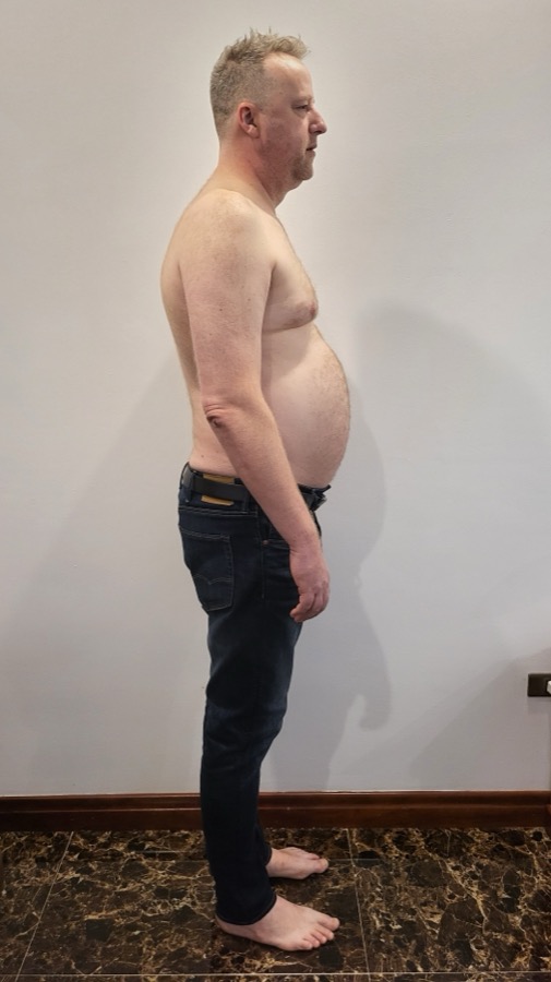 Marcel trước keto, tháng 10 năm 2022